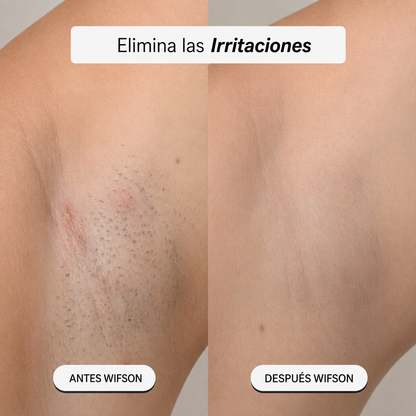 Depiladora 5-en-1 Wifson®